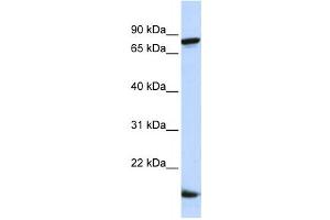 Western Blotting (WB) image for anti-Zinc Finger Protein 281 (ZNF281) antibody (ABIN2458356)