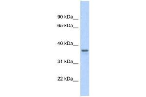 GAPDH antibody used at 1 ug/ml to detect target protein. (GAPDH antibody  (Middle Region))