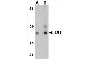 Western blot analysis of LIS1 in HeLa cell lysate AP30511PU-N at (A) 0.