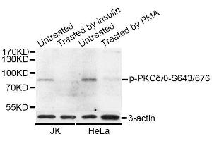 Western blot analysis of extracts of HeLa and 293 cells, using Phospho-PKCδ/θ-S643/676 antibody (ABIN5996816) at 1/1000 dilution. (PKC delta/theta (pSer643), (pSer676) antibody)
