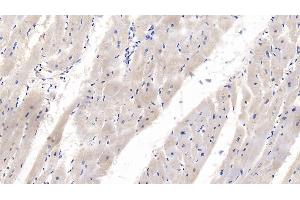 Immunohistochemistry (IHC) image for anti-Wingless-Type MMTV Integration Site Family, Member 4 (WNT4) (AA 26-351) antibody (ABIN7427258)