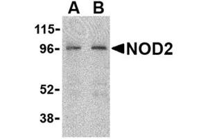 Image no. 1 for anti-Phorbol-12-Myristate-13-Acetate-Induced Protein 1 (PMAIP1) (N-Term) antibody (ABIN318707) (NOXA antibody  (N-Term))