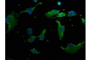 Immunofluorescence staining of U251 cells with ABIN7140118 at 1:50, counter-stained with DAPI. (RHBDD3 antibody  (AA 304-323))