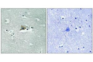 Immunohistochemical analysis of paraffin-embedded human brain tissue using Claudin 5 (Phospho-Tyr217) antibody (left)or the same antibody preincubated with blocking peptide (right). (Claudin 5 antibody  (pTyr217))