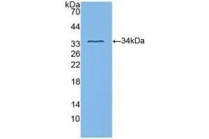 Detection of Recombinant ITGb3, Human using Polyclonal Antibody to Integrin Beta 3 (ITGb3) (Integrin beta 3 antibody  (AA 135-377))
