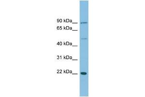 WB Suggested Anti-DNAJC12 Antibody Titration: 0. (DNAJC12 antibody  (Middle Region))