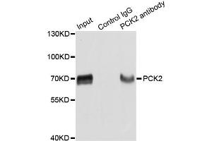 Immunoprecipitation analysis of extracts of HepG2 cells using PCK2 antibody. (PEPCK antibody)