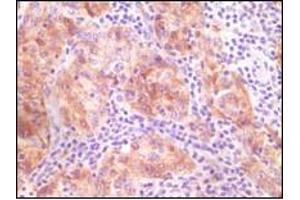 Immunohistochemistry (IHC) image for anti-Synuclein, gamma (Breast Cancer-Specific Protein 1) (SNCG) (truncated) antibody (ABIN2464104) (SNCG antibody  (truncated))