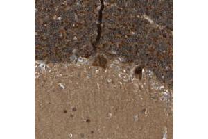 Immunohistochemical staining of human cerebellum with NDRG3 polyclonal antibody  shows strong cytoplasmic positivity in purkinje cells and in cells of granular layer at 1:20-1:50 dilution.