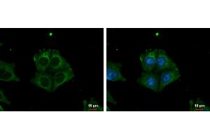 ICC/IF Image TRIM32 antibody detects TRIM32 protein at cytoplasm by immunofluorescent analysis. (TRIM32 antibody)