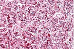 ABIN571194 (5µg/ml) staining of paraffin embedded Human Adrenal Gland. (ETFA antibody  (AA 139-152))