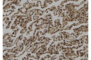 ABIN6272990 at 1/100 staining Human lung tissue by IHC-P. (AGTPBP1 antibody  (Internal Region))