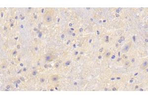 Detection of F5 in Mouse Cerebellum Tissue using Polyclonal Antibody to Coagulation Factor V (F5)