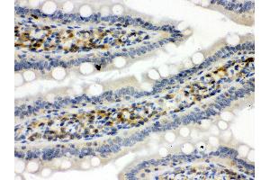 Immunohistochemistry (IHC) image for anti-Signal Transducer and Activator of Transcription 1, 91kDa (STAT1) (AA 114-143), (N-Term) antibody (ABIN3043938)