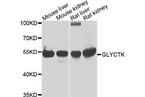 Western blot analysis of extracts of various cell lines, using GLYCTK antibody. (GLYCTK antibody)