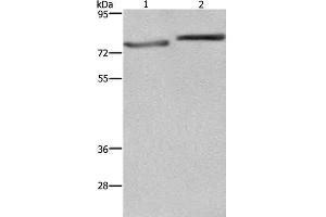 Western Blot analysis of PC3 and Hela cell using COMP Polyclonal Antibody at dilution of 1:600 (COMP antibody)