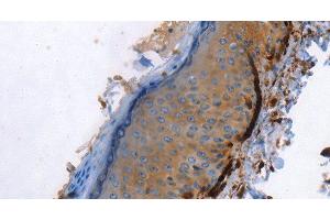 Immunohistochemistry of paraffin-embedded Human skin using Caldesmon Polyclonal Antibody at dilution of 1:40 (Caldesmon antibody)