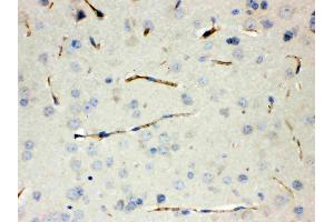 Calcitonin was detected in paraffin-embedded sections of mouse lung tissues using rabbit anti- Calcitonin Antigen Affinity purified polyclonal antibody (Catalog # ) at 1 µg/mL. (CGRP antibody  (C-Term))