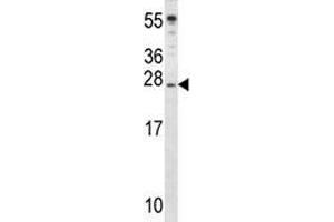 IGF2 antibody western blot analysis in mouse cerebellum tissue lysate. (IGF2 antibody  (AA 39-68))