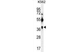 Western Blotting (WB) image for anti-Melanoma Antigen Family A, 12 (MAGEA12) antibody (ABIN3002530)