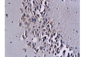 Formalin-fixed and paraffin embedded mouse brain tissue  labeled with Anti-CXCL16 Polyclonal Antibody, unconjugated  (ABIN686572) followed by incubation with conjugated secondary antibody and DAB staining (CXCL16 antibody  (AA 85-200))