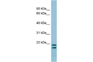 WB Suggested Anti-SFTPC Antibody Titration:  0. (Surfactant Protein C antibody  (N-Term))