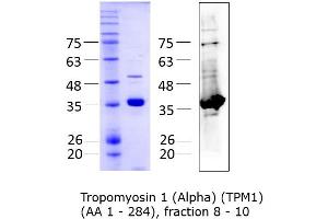 Quality Control Images: Western Blotting + SDS-PAGE (Tropomyosin Protein (AA 1-284) (Strep Tag))