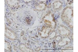 Image no. 4 for anti-Actin-Related Protein 2 (ACTR2) (AA 1-395) antibody (ABIN599116) (ACTR2 antibody  (AA 1-395))