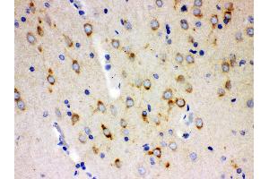 Anti- SSH3BP1 Picoband antibody, IHC(P) IHC(P): Rat Brain Tissue (ABI1 antibody  (N-Term))