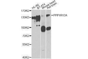 Western blot analysis of extracts of various cell lines, using PPP1R12A antibody. (PPP1R12A antibody)