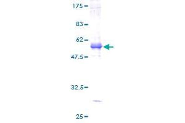 SLC30A6 Protein (AA 1-216) (GST tag)