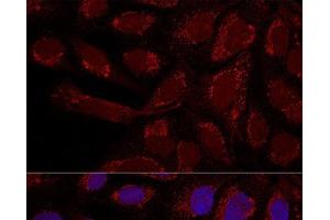 Confocal immunofluorescence analysis of U2OS cells using MTX1 Polyclonal Antibody at dilution of 1:100. (Metaxin 1 antibody)