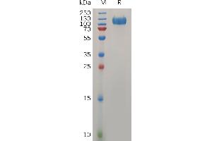 IFNAR1 Protein (AA 28-436) (mFc Tag)