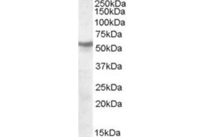 Western Blotting (WB) image for anti-Nicotinic Acetylcholine Receptor beta (CHRNB1) (Internal Region) antibody (ABIN2466671) (CHRNB1 antibody  (Internal Region))