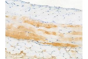 ABIN6256242 and ABIN6267094 at 1/100 staining Mouse skin tissue by IHC-P. (ATG14 antibody  (pSer29))