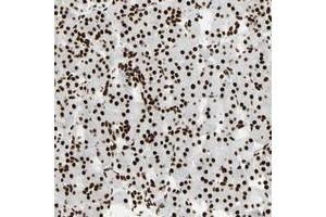 Immunohistochemical staining of human pancreas with CCAR1 polyclonal antibody  shows strong nuclear positivity in exocrine glandular cells.