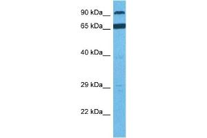 Host:  Rabbit  Target Name:  RHBDF1  Sample Tissue:  Human PANC1 Whole Cell  Antibody Dilution:  1ug/ml (RHBDF1 antibody  (N-Term))