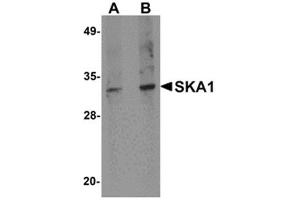 Western blot analysis of SKA1 in A549 cell lysate with SKA1 antibody at 0.