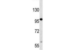 RNF43 antibody western blot analysis in CEM lysate. (RNF43 antibody  (AA 543-572))