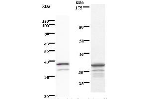 Left: rps6ka4 staining. (MSK2 antibody)