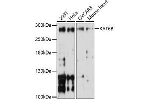 Western blot analysis of extracts of various cell lines, using KB antibody (ABIN7268062) at 1:1000 dilution. (KAT6B antibody  (AA 400-500))