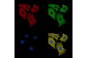 Laminin 2 alpha Mouse Monoclonal Antibody staining HepG2 cells by IF/ICC.