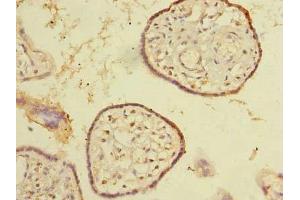 Immunohistochemistry of paraffin-embedded human placenta tissue using ABIN7170360 at dilution of 1:100 (SNX16 antibody  (AA 1-342))