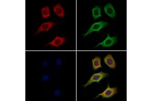 ABIN6265828 and ABIN6269033 staining Hela cells by IF/ICC. (TYR antibody  (C-Term))