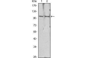 Western blot analysis using HDAC4 mouse mAb against Hela (1), Jurkat (2) cell lysate. (HDAC4 antibody)