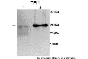 Sample type: 1. (TPI1 antibody  (N-Term))