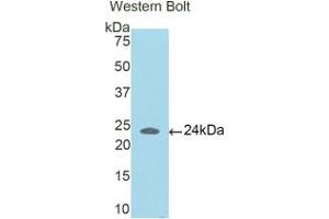 Western blot analysis of the recombinant protein. (CCDC80 antibody  (AA 81-258))