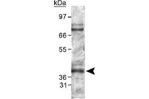 Western blot analysis of PHD2 in mouse kidney lysate using Egln1 polyclonal antibody . (EGLN1 antibody  (AA 300-400))