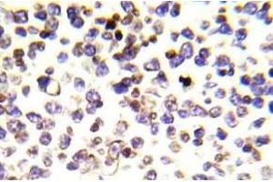 Immunohistochemistry (IHC) analyzes of Histone H2A. (H2AFX antibody)