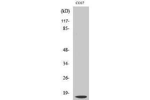 Western Blotting (WB) image for anti-Cathepsin D (CTSD) (Cleaved-Gly65), (Light Chain) antibody (ABIN3172759) (Cathepsin D antibody  (Cleaved-Gly65, Light Chain))
